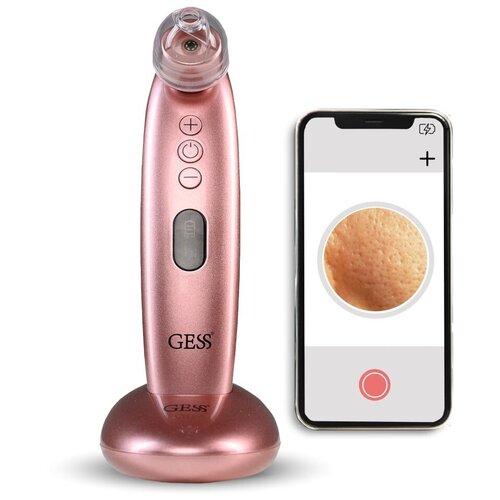 GESS прибор для вакуумной чистки и микродермабразии лица Sleek 145 - розовый